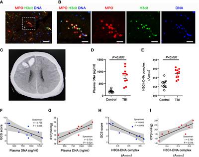 Inhibition of neutrophil extracellular trap formation attenuates NLRP1-dependent neuronal pyroptosis via STING/IRE1α pathway after traumatic brain injury in mice